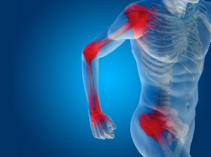 pain advice from our xtoke on trent chiropractor 