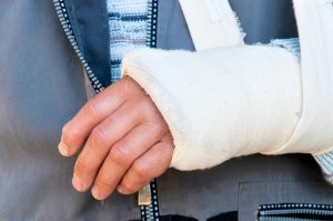 bone health advice from a chiropractor in stoke-on-trent